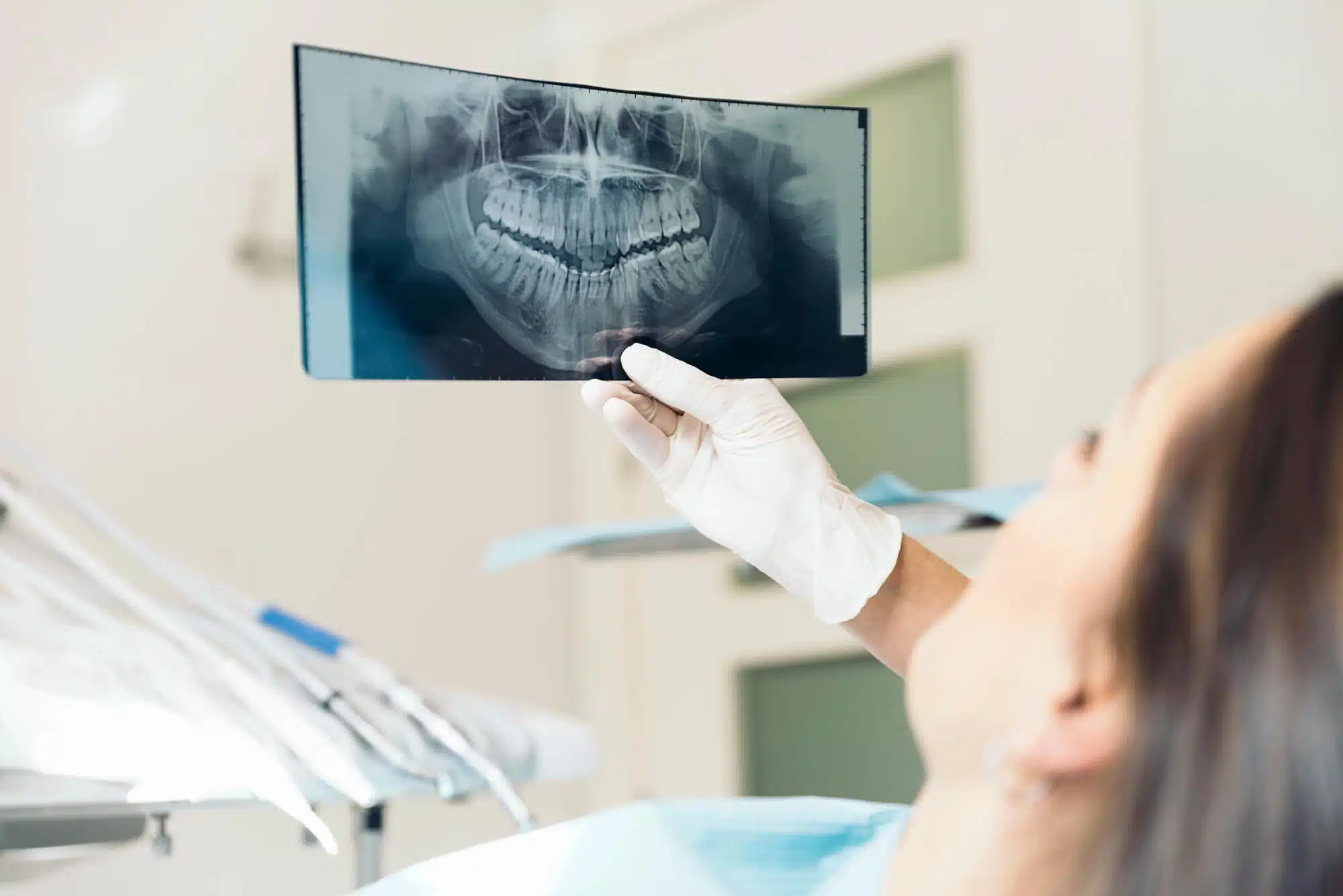 Dental Xray for osseous surgery palm beach gardens
