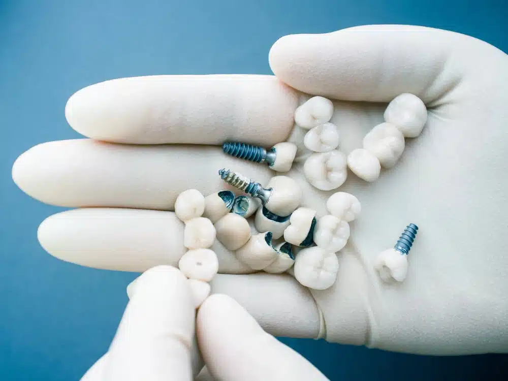 dental implant surgery palm beach gardens.