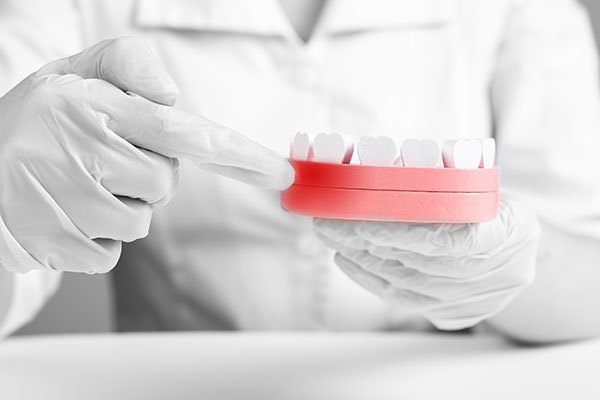 Common Causes Of Gum Disease