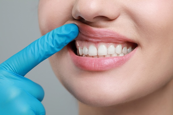 Reasons For An Oral Surgeon Gum Grafting Procedure