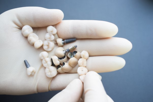 What Is A Dental Implant Professional?