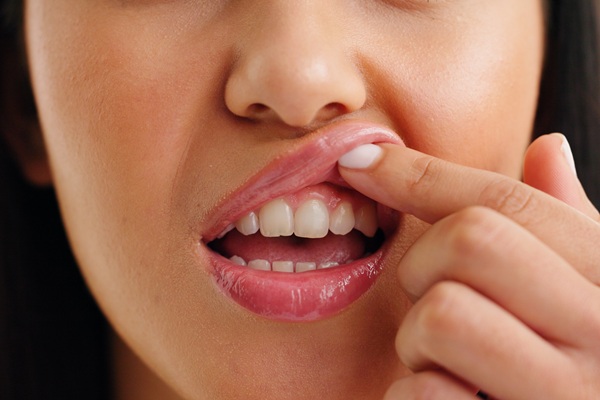 How A Periodontist Can Help With Receding Gums